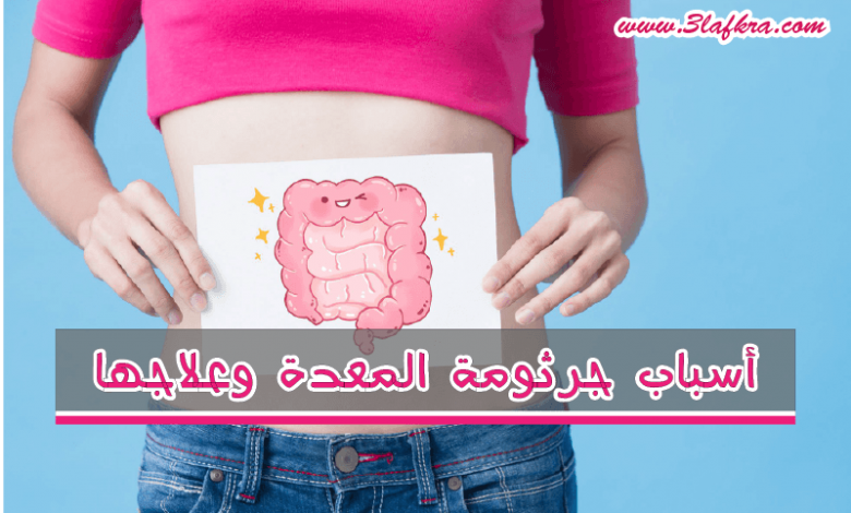 أسباب جرثومة المعدة وعلاجها